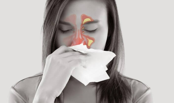 Sinus Infections