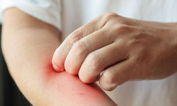 Urgent Care for Skin Rash