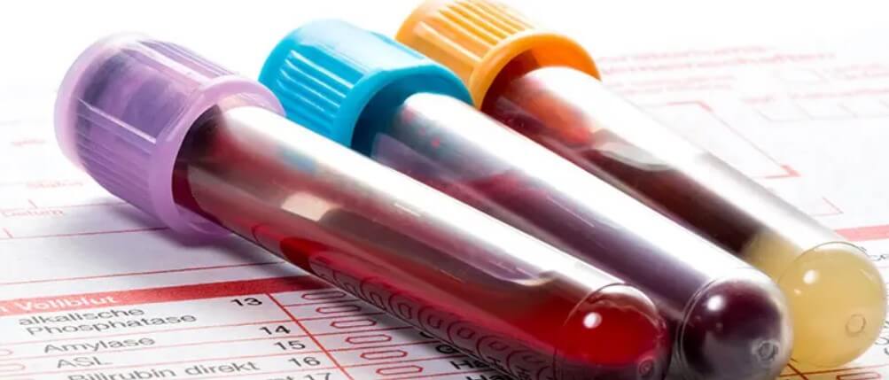 Blood Work Labs